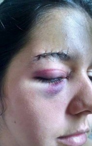 Estudante foi agredida por assaltantes no último domingo